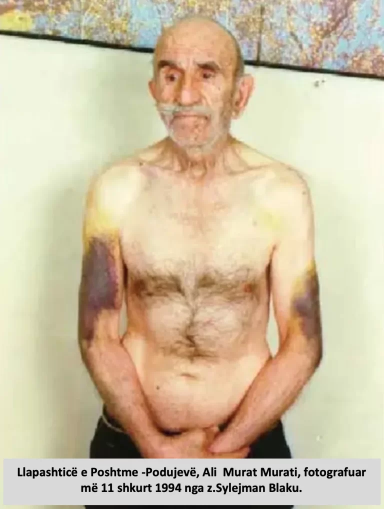 E vërteta e fotografisë së z. Ali Murat Murati nga Llapashtica e Poshtme e Podujevës, keqtrajtuar me 11 shkurt 1994 nga policia serbe
